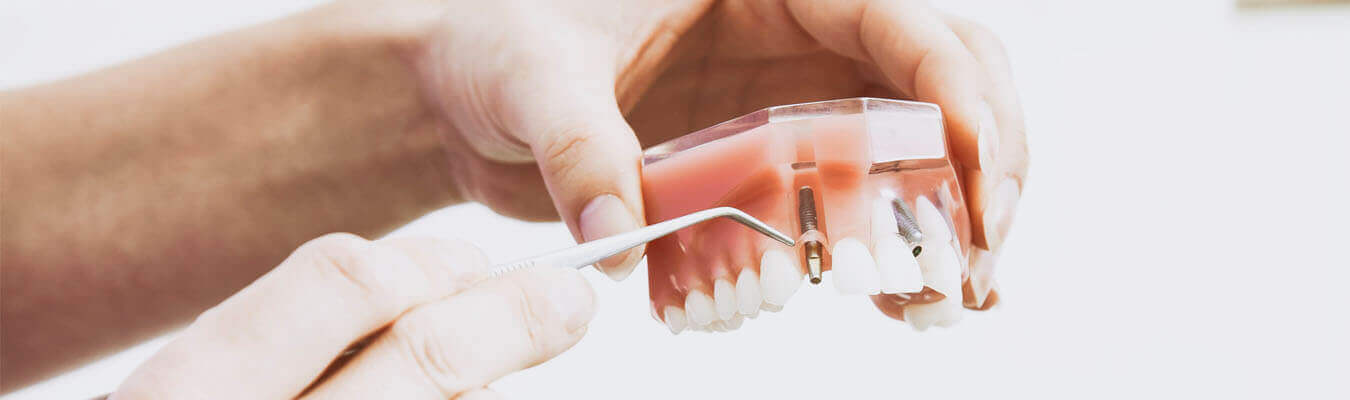 Carrera Tecnica Profesional de Protesis Dental